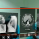 En el cuadrado, y a ojo, lo que de verdad se ve cuando llevas puestas unas Hololens. La imagen se ve borrosa porque proviene del streaming que hacen la gafas, pero en realidad la resolución es bastante buena.